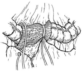pagenumber_ebook=382,pagenumber_book=367