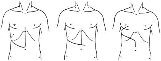 pagenumber_ebook=84,pagenumber_book=69