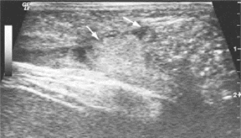 pagenumber_ebook=660,pagenumber_book=660