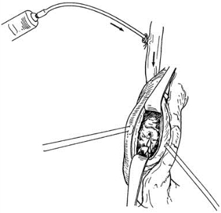 pagenumber_ebook=443,pagenumber_book=428