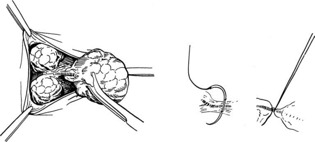 pagenumber_ebook=603,pagenumber_book=588