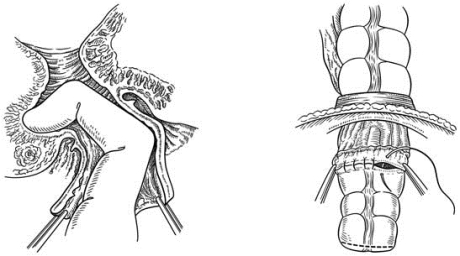 pagenumber_ebook=140,pagenumber_book=125