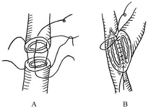 pagenumber_ebook=241,pagenumber_book=226
