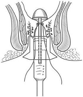 pagenumber_ebook=610,pagenumber_book=595