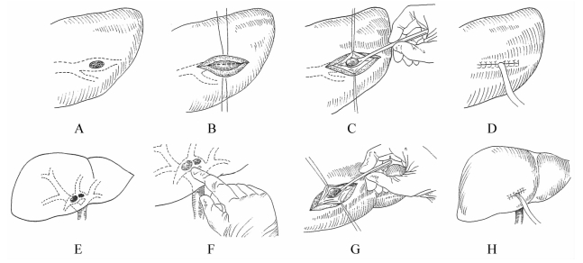 pagenumber_ebook=314,pagenumber_book=306