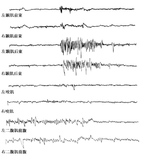 pagenumber_ebook=156,pagenumber_book=147
