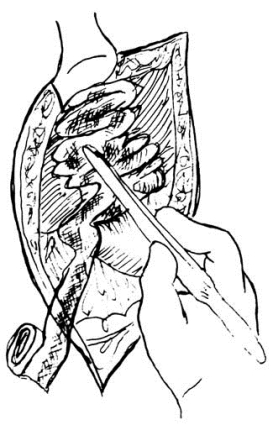 pagenumber_ebook=576,pagenumber_book=561