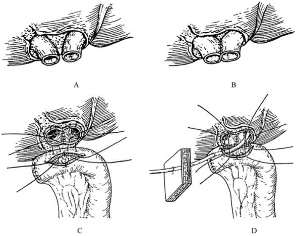 pagenumber_ebook=456,pagenumber_book=441