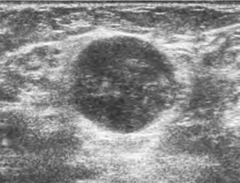 pagenumber_ebook=171,pagenumber_book=171