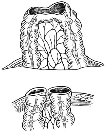 pagenumber_ebook=571,pagenumber_book=556