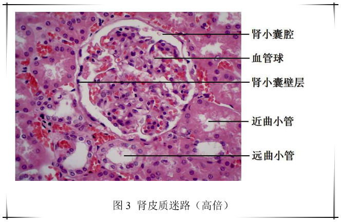 capsule):为双层,肾小囊外周单层扁平上皮构成肾小囊壁层;肾