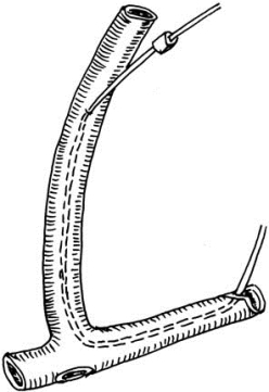 pagenumber_ebook=537,pagenumber_book=522