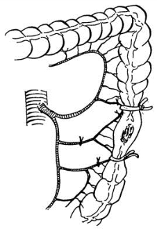 pagenumber_ebook=390,pagenumber_book=375