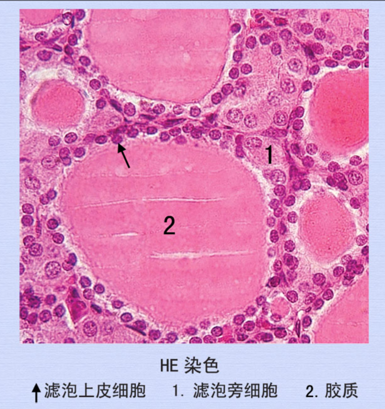 甲状腺高倍镜像.png