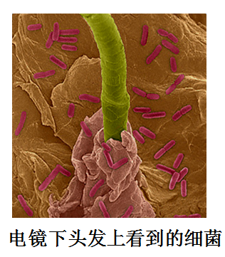 球菌:单球菌,双球菌,链球菌,四联球菌,八叠球菌,葡萄球菌