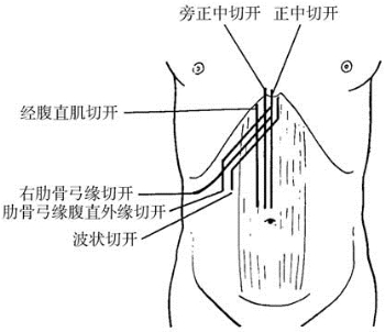 pagenumber_ebook=441,pagenumber_book=426