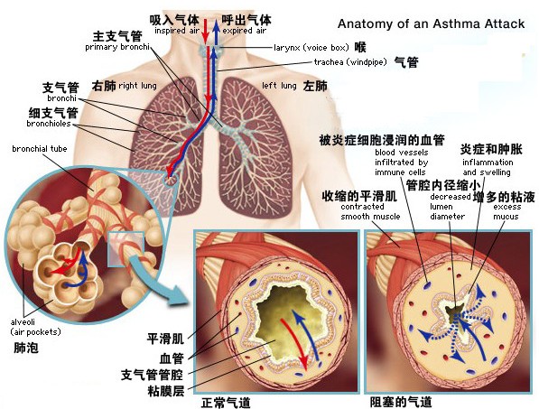 第三章  支气管哮喘