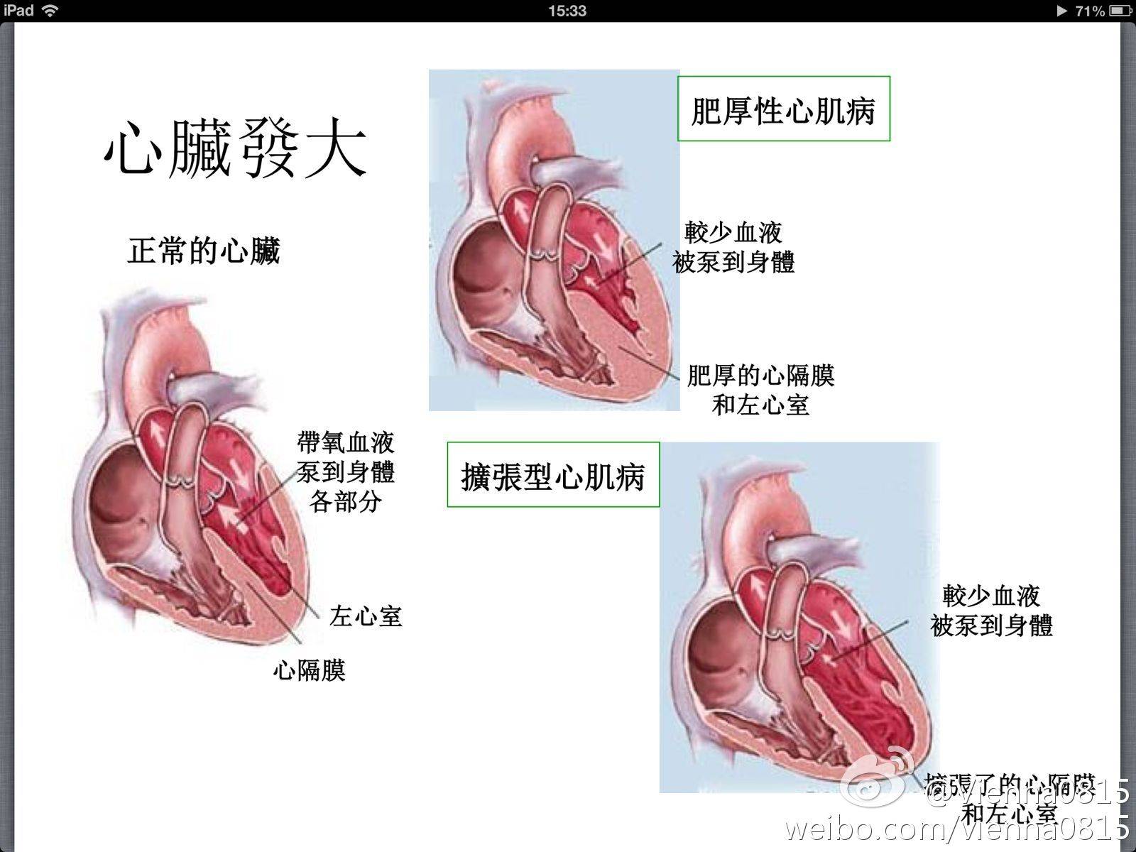 第八章  心肌疾病