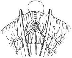 pagenumber_ebook=367,pagenumber_book=352