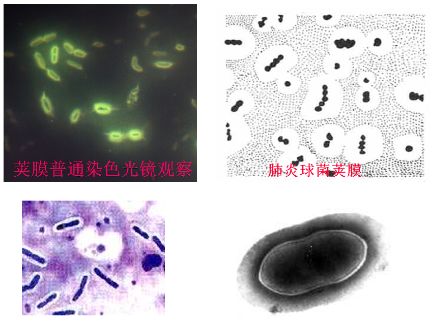 第三节  细菌的特殊结构 细菌的特殊结构 细菌的特殊结构包括荚膜