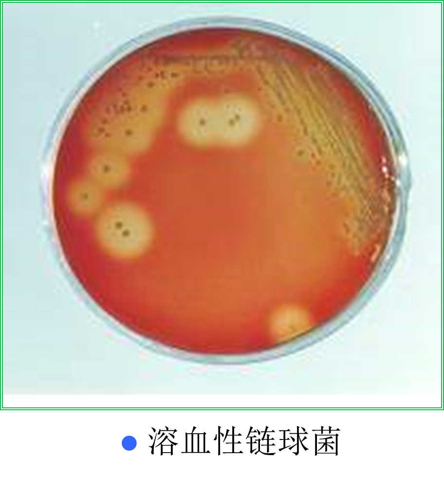 确诊:血液琼脂平板分离培养,观察菌落,溶血等特征,并进行生理生化试验