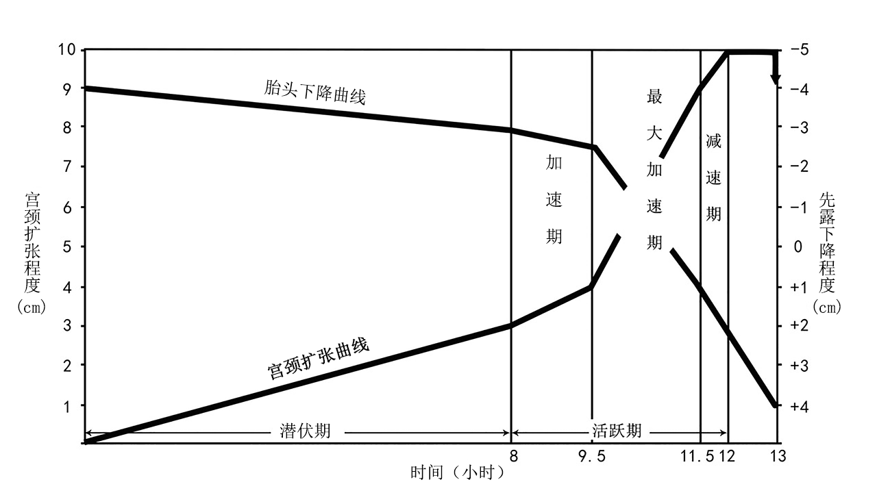 产程图