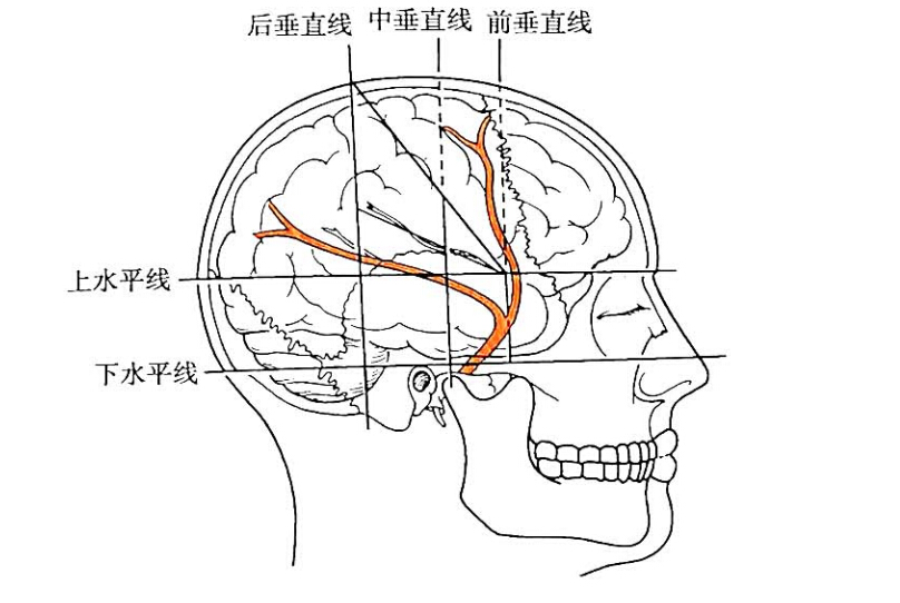 翼点的投影  相当于前垂直线与上水平线的交点(大约在颧弓中点上方2