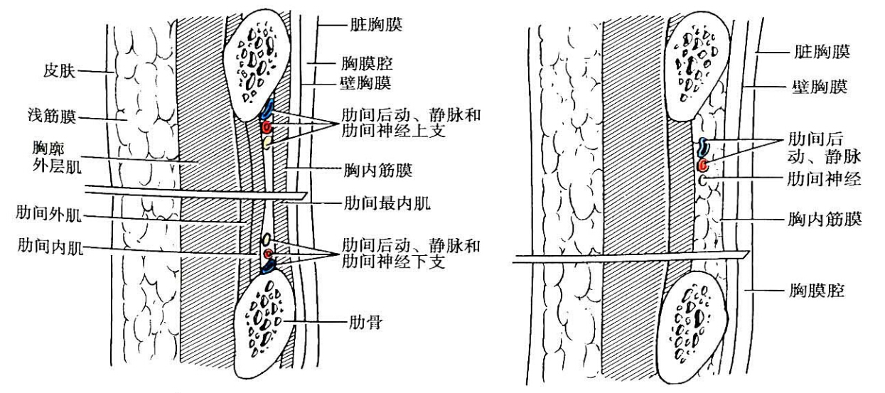 线栓长度对颈内动脉穿刺法建立大鼠蛛网膜下腔出血模型的影响