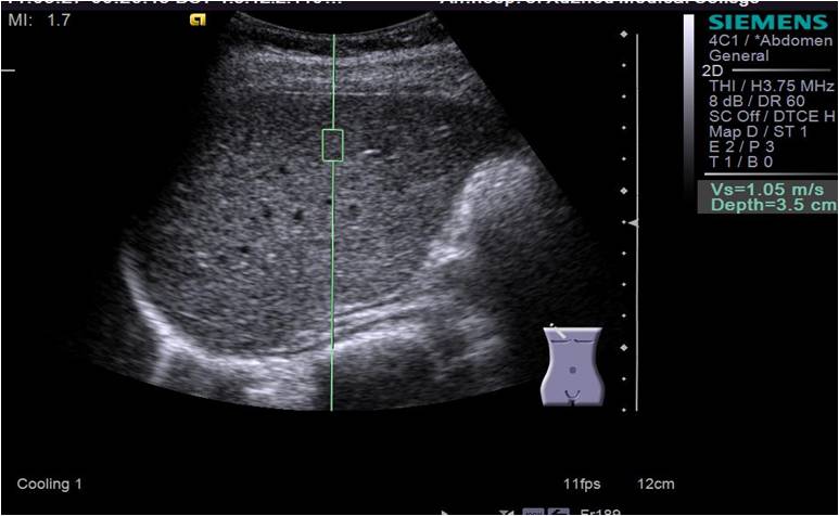 肝脏gdp值_肝脏位置(3)