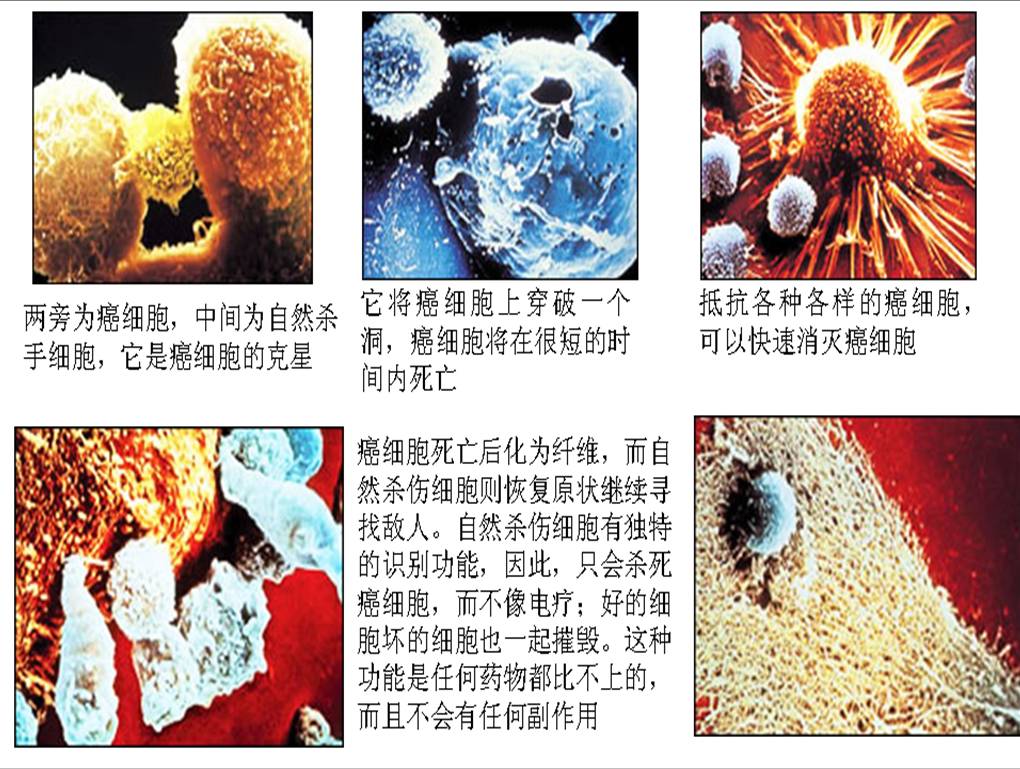 NK杀死癌细胞.jpg