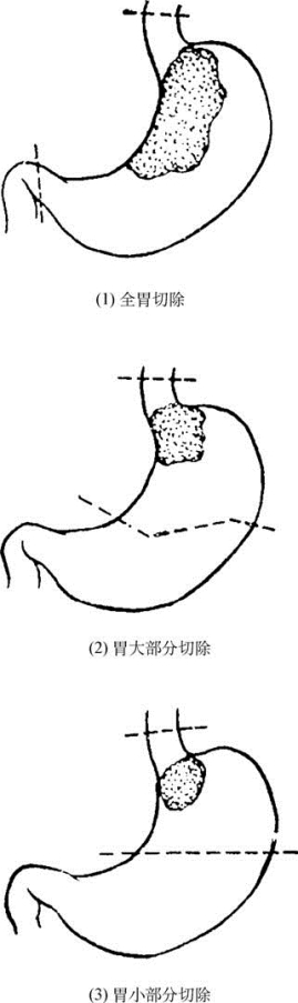 pagenumber_ebook=320,pagenumber_book=305