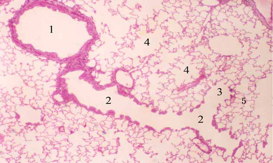 1,终末细支气管   2,呼吸性细支气管 3,肺泡管    4,肺泡囊   5,肺泡