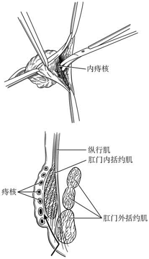pagenumber_ebook=602,pagenumber_book=587