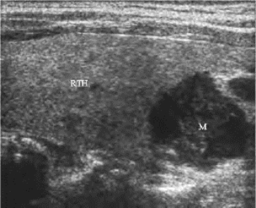 pagenumber_ebook=160,pagenumber_book=160