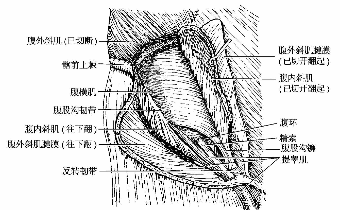 腹横肌 腰方肌 腹股沟管-运动解剖学-图片