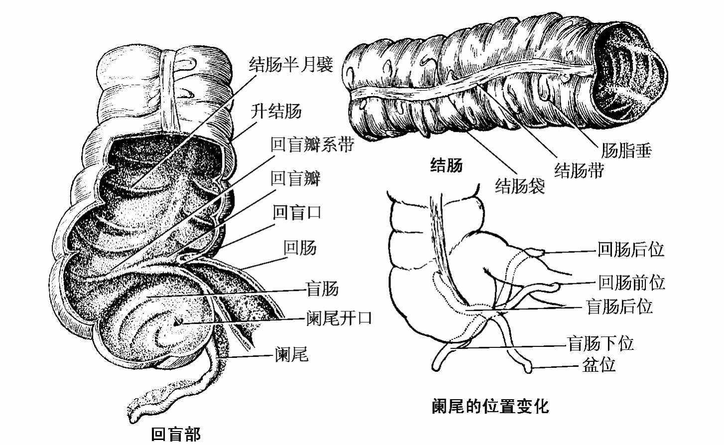 人体阑尾位置示意图-图库-五毛网