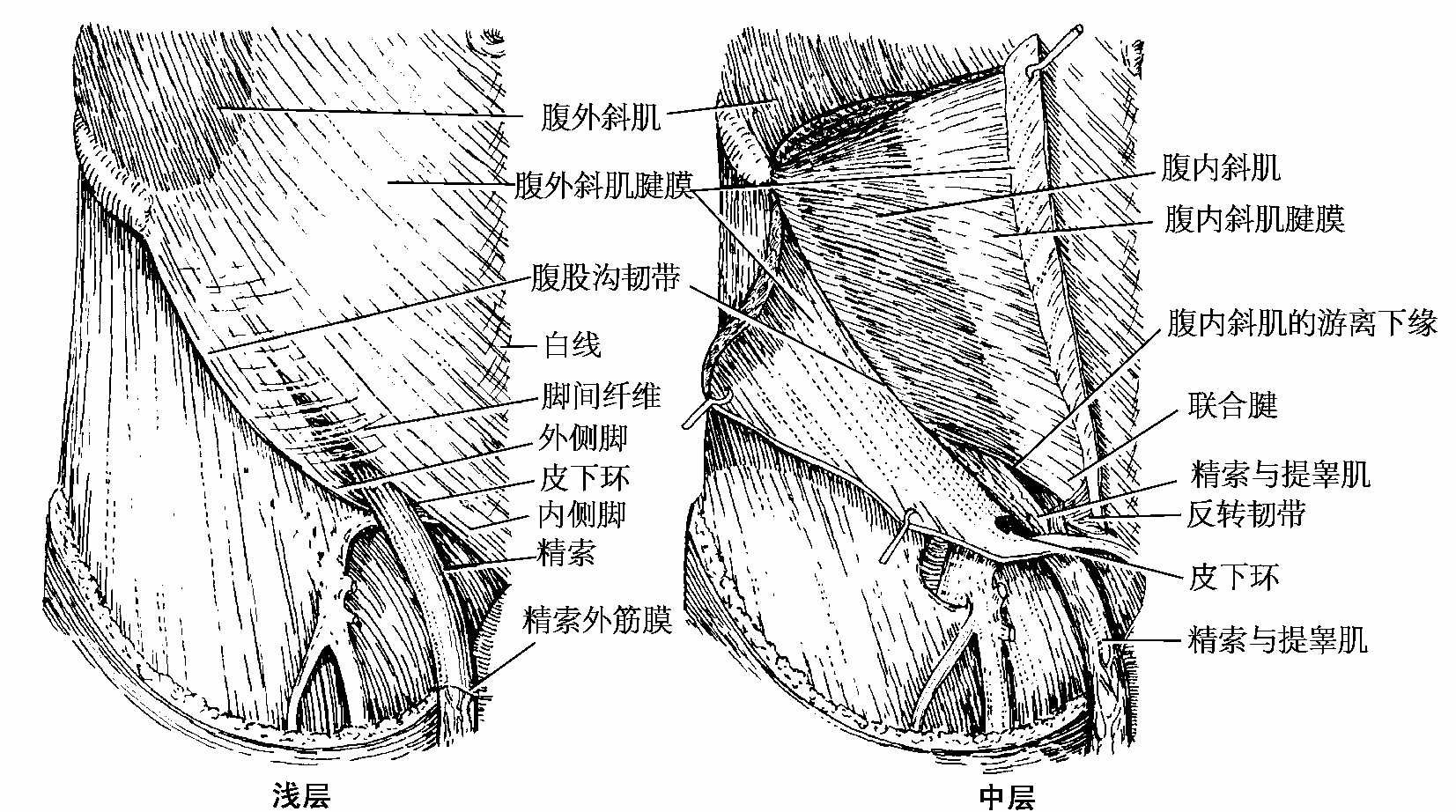 腹股沟管解剖图-千图网