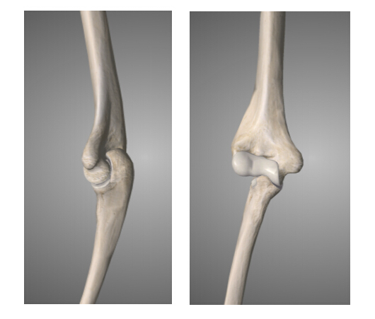 由肱骨滑车与尺骨半月切迹构成,属于蜗状关节,是肘关节的主体部分.
