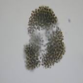 6 铜绿微囊藻.jpg