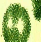 6-3 铜绿微囊藻.jpg