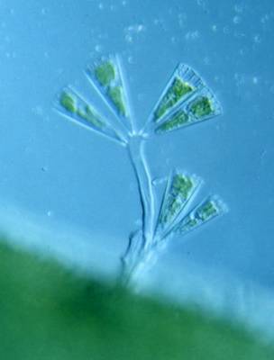 29 异极藻群体.jpg