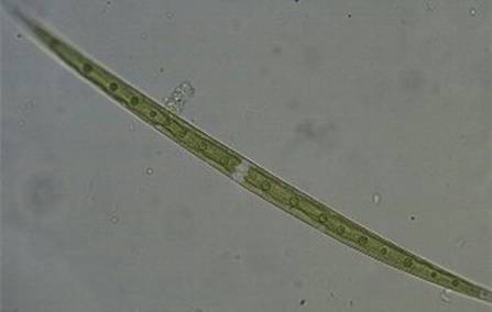 78 纤细新月藻.jpg