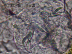 19 萼花臂尾轮虫槌型.jpg