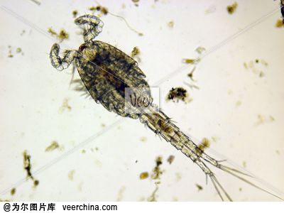 3 雄性剑水蚤.jpg
