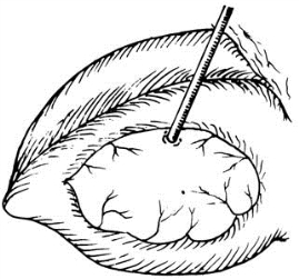 pagenumber_ebook=483,pagenumber_book=468