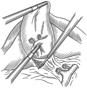 pagenumber_ebook=458,pagenumber_book=443