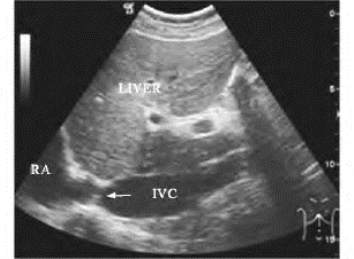 pagenumber_ebook=672,pagenumber_book=672
