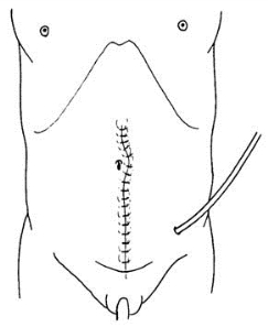 pagenumber_ebook=394,pagenumber_book=379