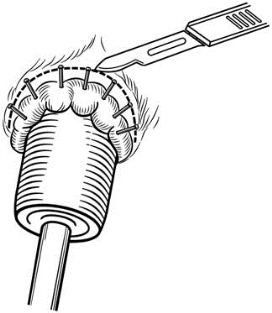 pagenumber_ebook=607,pagenumber_book=592