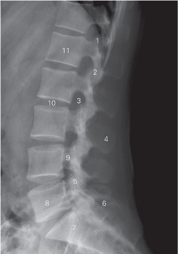pagenumber_ebook=160,pagenumber_book=151